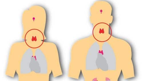 Can stress cause Cardiac arrest?