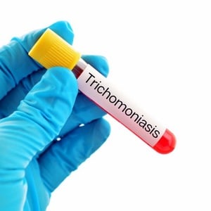 Trichomoniasis Test Kit Home