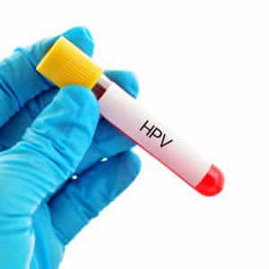 HPV Test. Variant type Men & women testing home